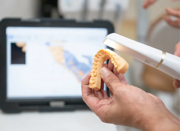 口腔内スキャナー