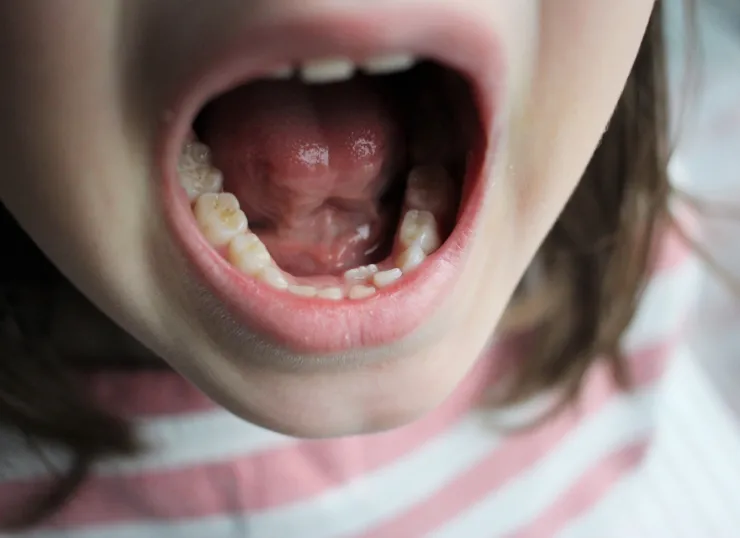 子どもの歯並びが気になったら