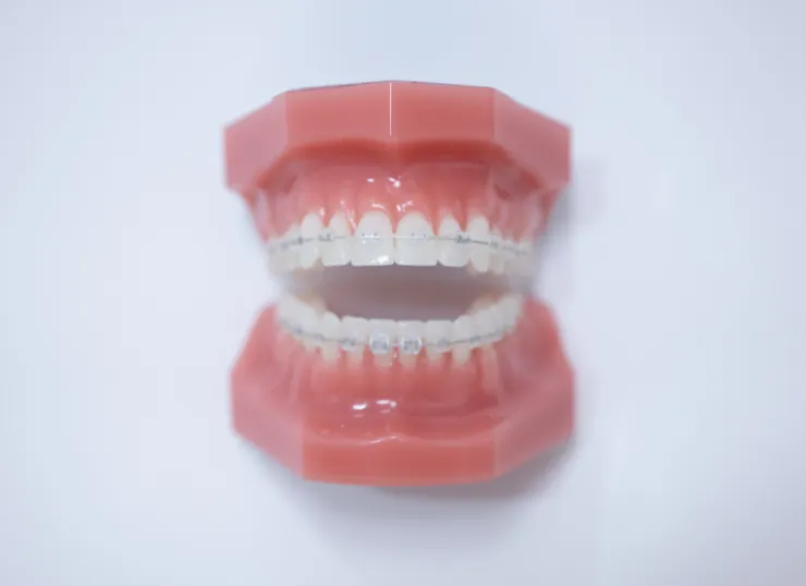 4. 矯正治療の高い専門性